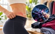 Allergie voor kleurstoffen in kleding: vrouw bekijkt geïrriteerde huid bij haar broekband